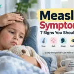 Measles Symptoms 7 Signs You Should Know