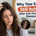 Why Your Scalp Still Itches After Anti-Dandruff Shampoo
